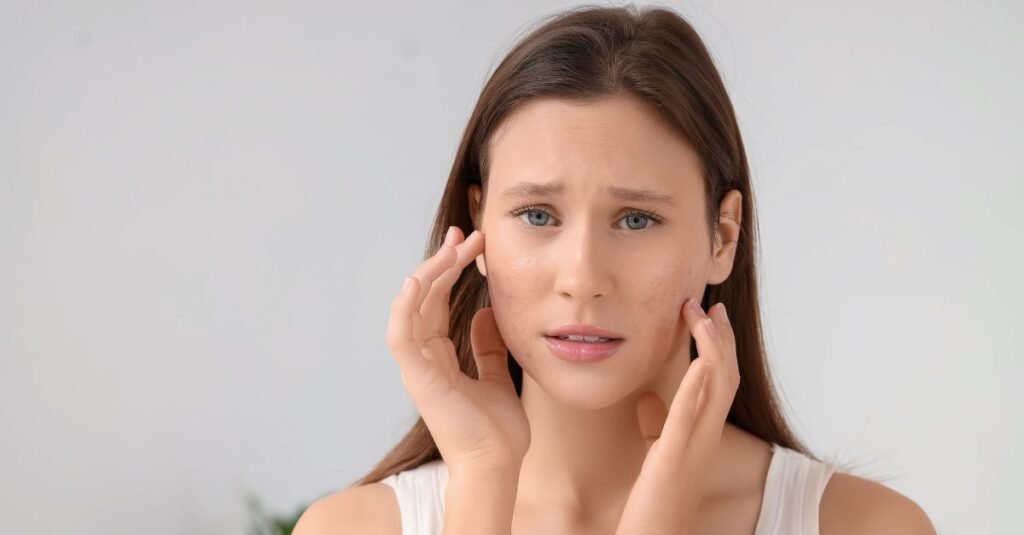 5 ways nutrition impacts acne – and how to heal holistically at skin envy & body